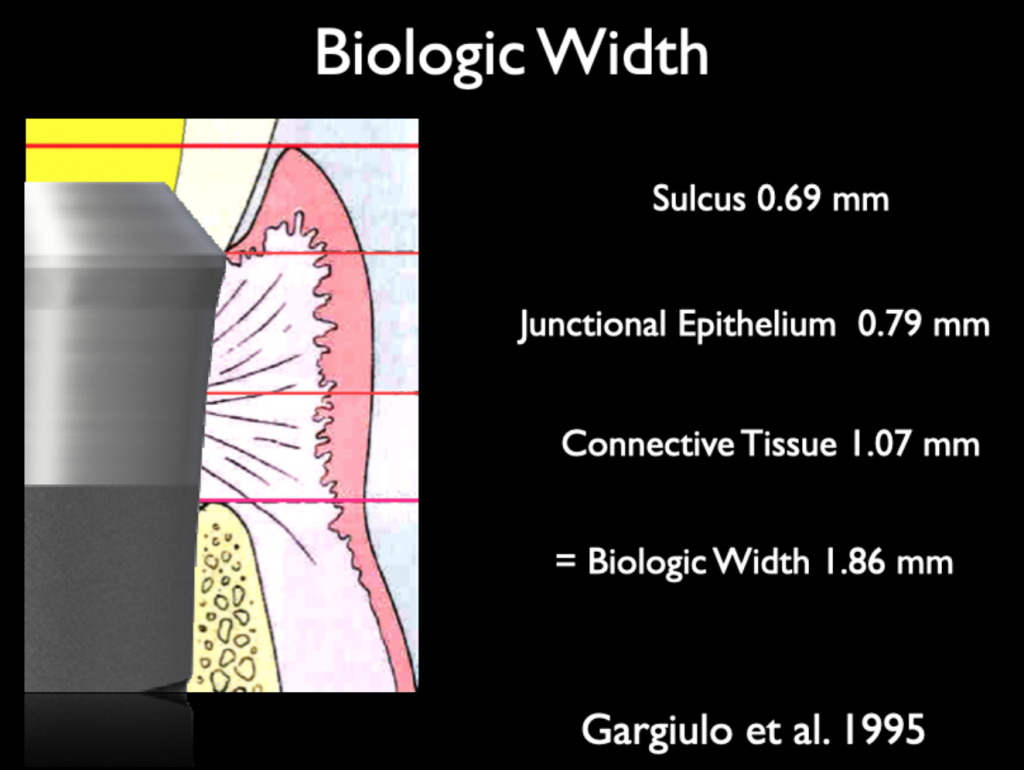 Fig. 3: Personal infographic to demonstrate concept of biologic width according to Gargiulo et al. (1995)