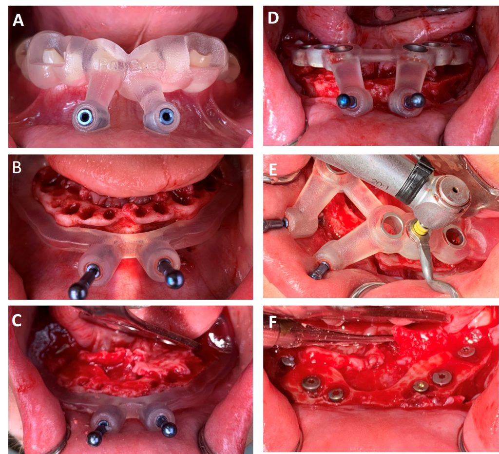 Ask a Dentist: How Long Do Clear Braces Last? - GK Dental PC