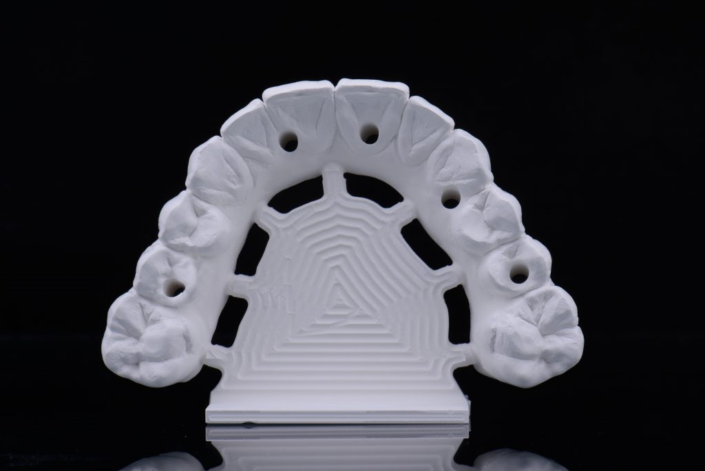 Monolithic zirconia IFCDP milled with the high refinement protocol