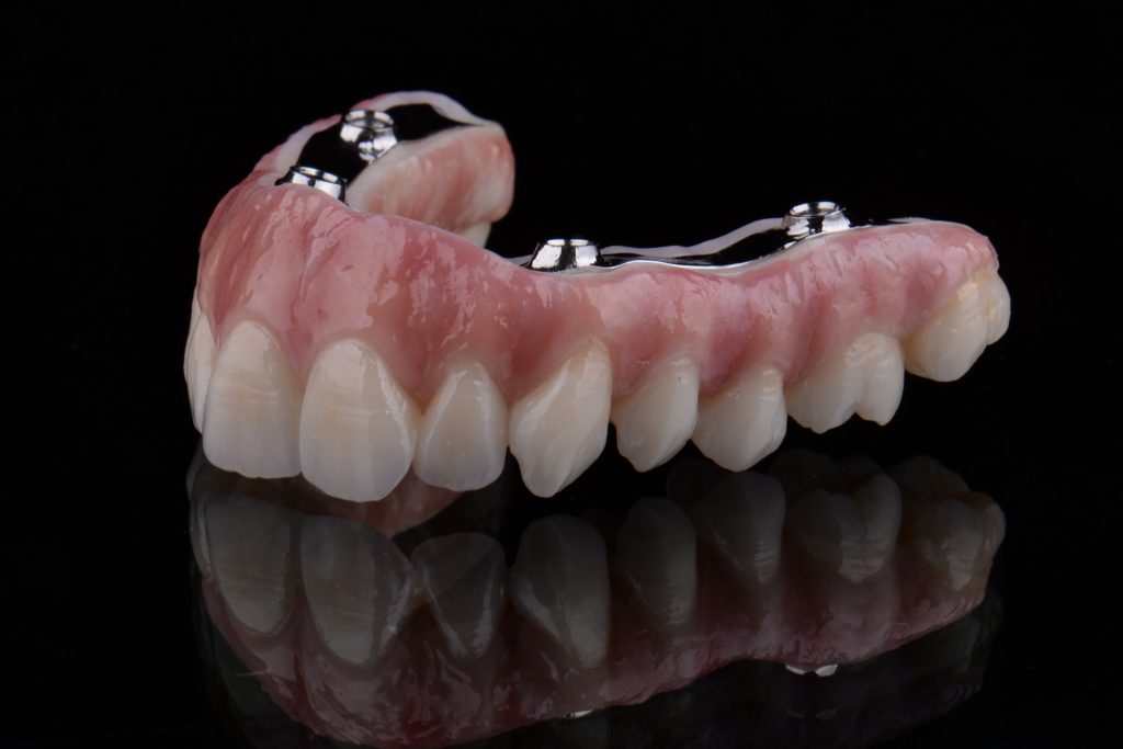 Titanium bar cemented to the zirconia IFCDP. Clean and polished intaglio of the IFCDP ready for delivery