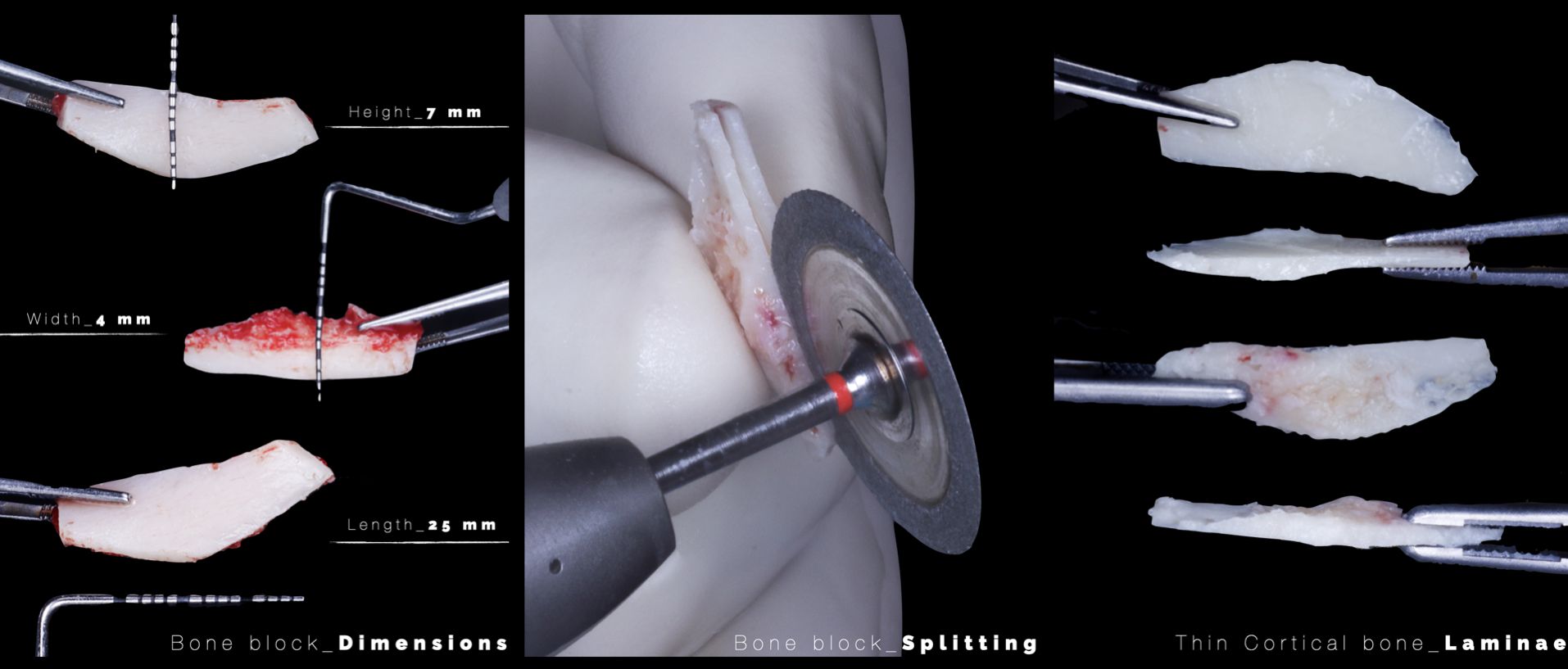 Digital trends and 3D technologies in bone augmentation procedures ...